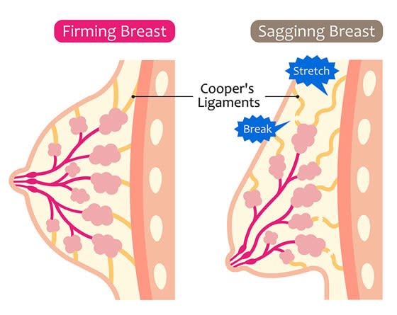 性同一性障害（GID）FTMの気になる悩み・胸オペ編（乳腺摘出/乳房切除） | 静岡美容外科 橋本クリニック