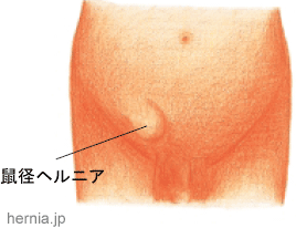 小児外科｜診療科｜診療科等一覧｜京都大学医学部附属病院