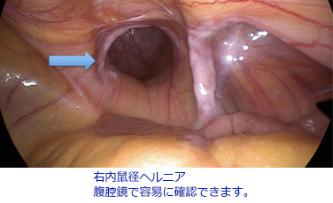 鍼灸治療が効果的な症例 | 2016年10月