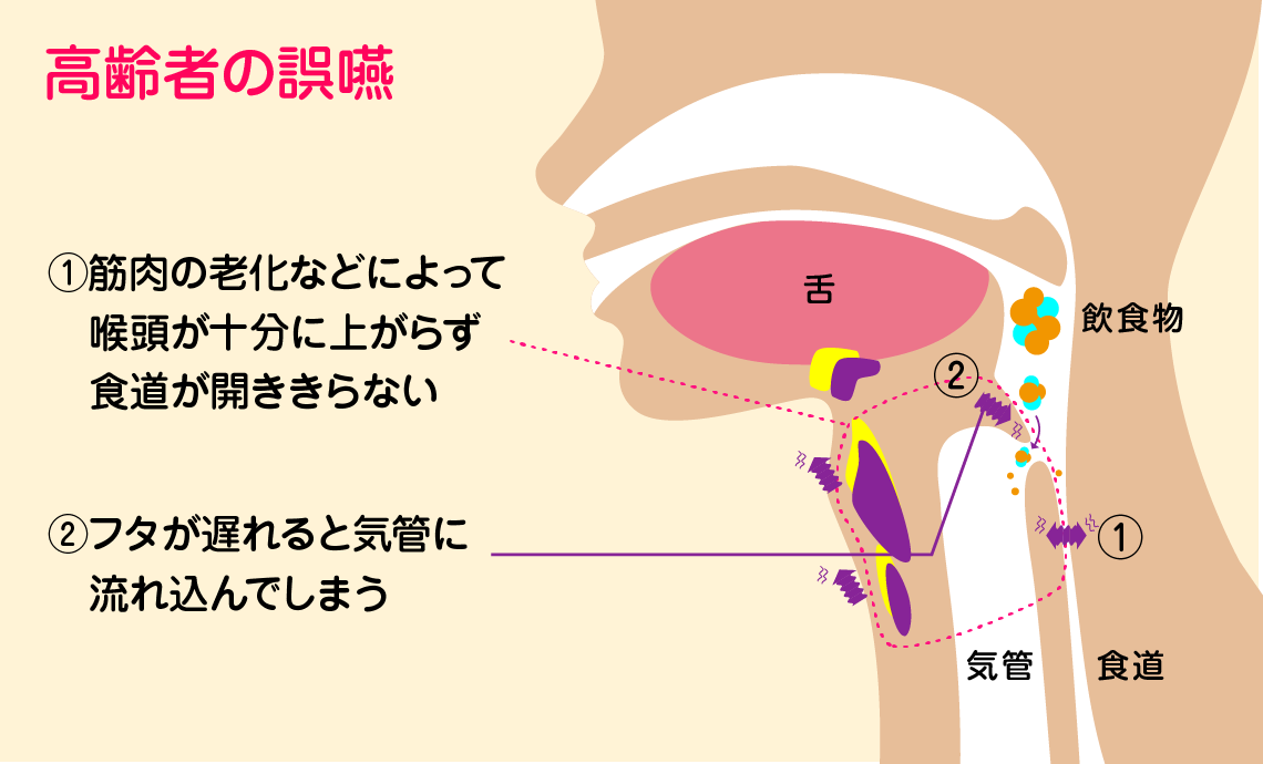 口臭対策】口が臭い！原因は病気の可能性も。知っておくべき簡単予防対策｜wakanote