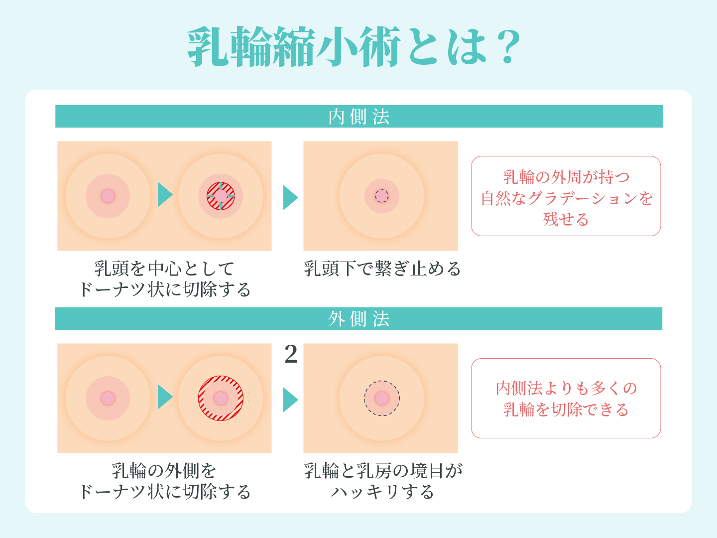 診療内容 | 脂肪豊胸専門の銀座3丁目•BANNAI美容クリニック