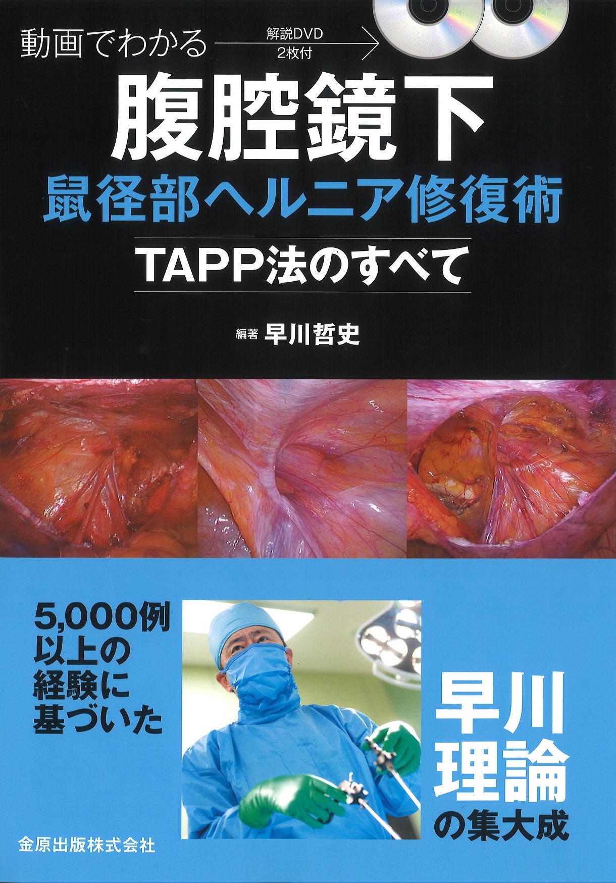 腹腔鏡による傷の目立たない鼠径ヘルニア（脱腸）手術｜白河那須総合クリニック｜福島県白河市・栃木県那須郡那須町・栃木県那須塩原市