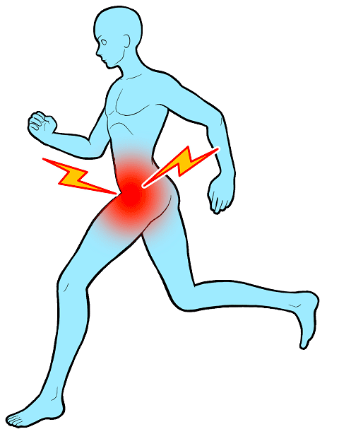 鼠径部(股関節)の痛み - 呉服町・博多駅東で整骨院をお探しならサンテ整骨院グループ