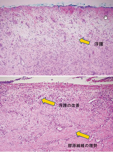 マカ（精力剤）の効果とは？男性器の勃起改善について医師が解説！ | メンズライフクリニック【公式】