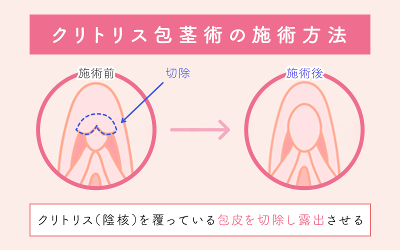 ホッキ貝の酢の物 - 私的標本：捕まえて食べる